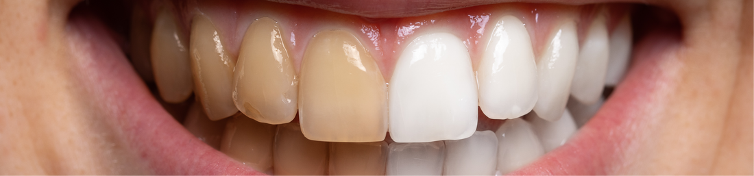 How do I remove stains from my bonding?